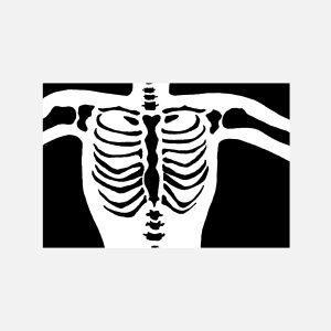 Skeleton Chest